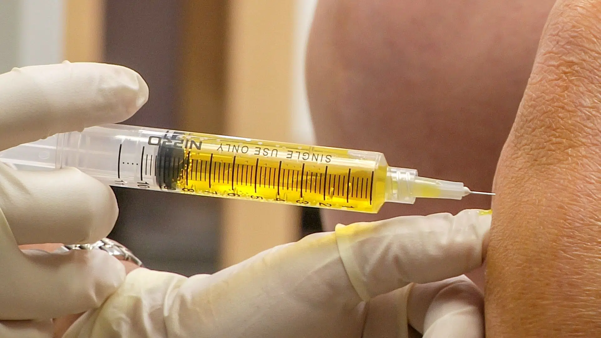 Hyaluronic Acid (HA) Knee Injections